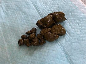 渡辺さんのオナラとウンコ　サンプル画像06